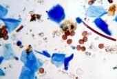 Mold Testing